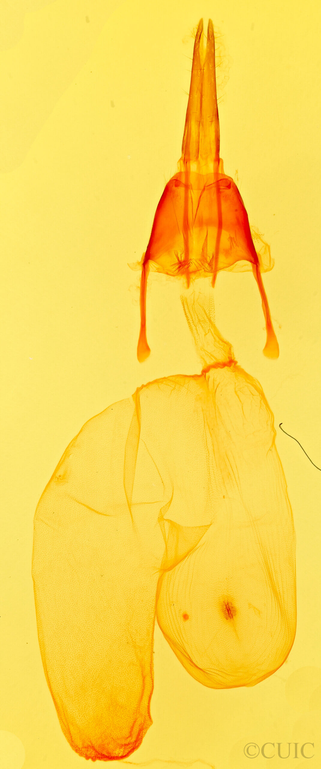 genitalia view of adult Feltia subgothica