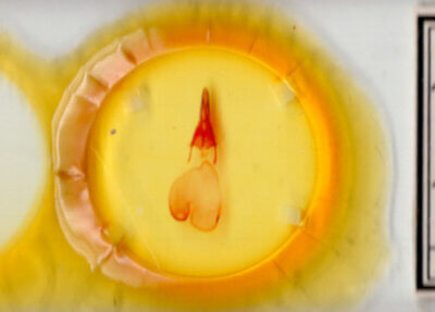 slide view of adult Feltia tricosa