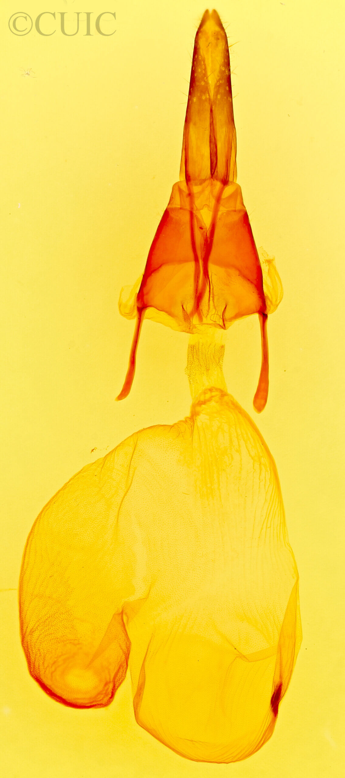 genitalia view of adult Feltia tricosa