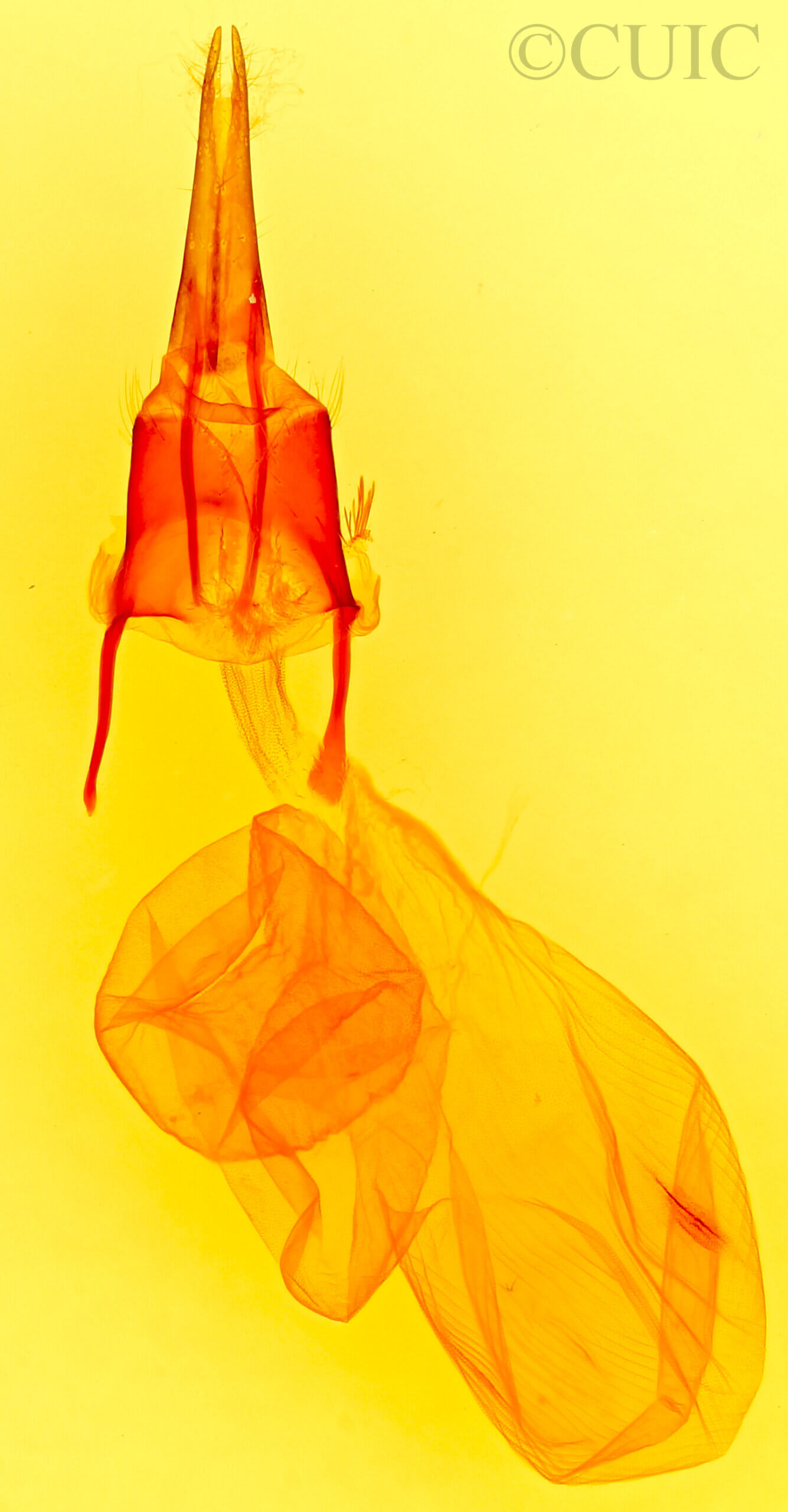 genitalia view of adult Feltia herilis