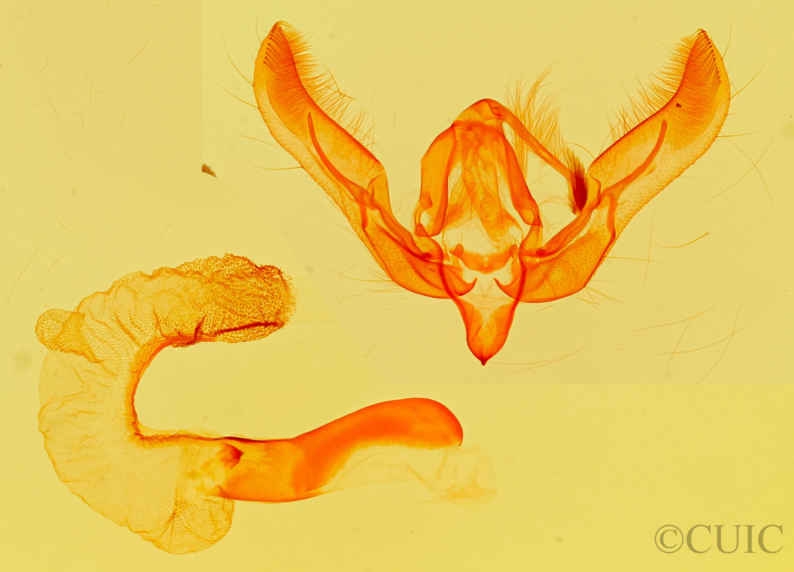 genitalia view of adult Feltia aculifera