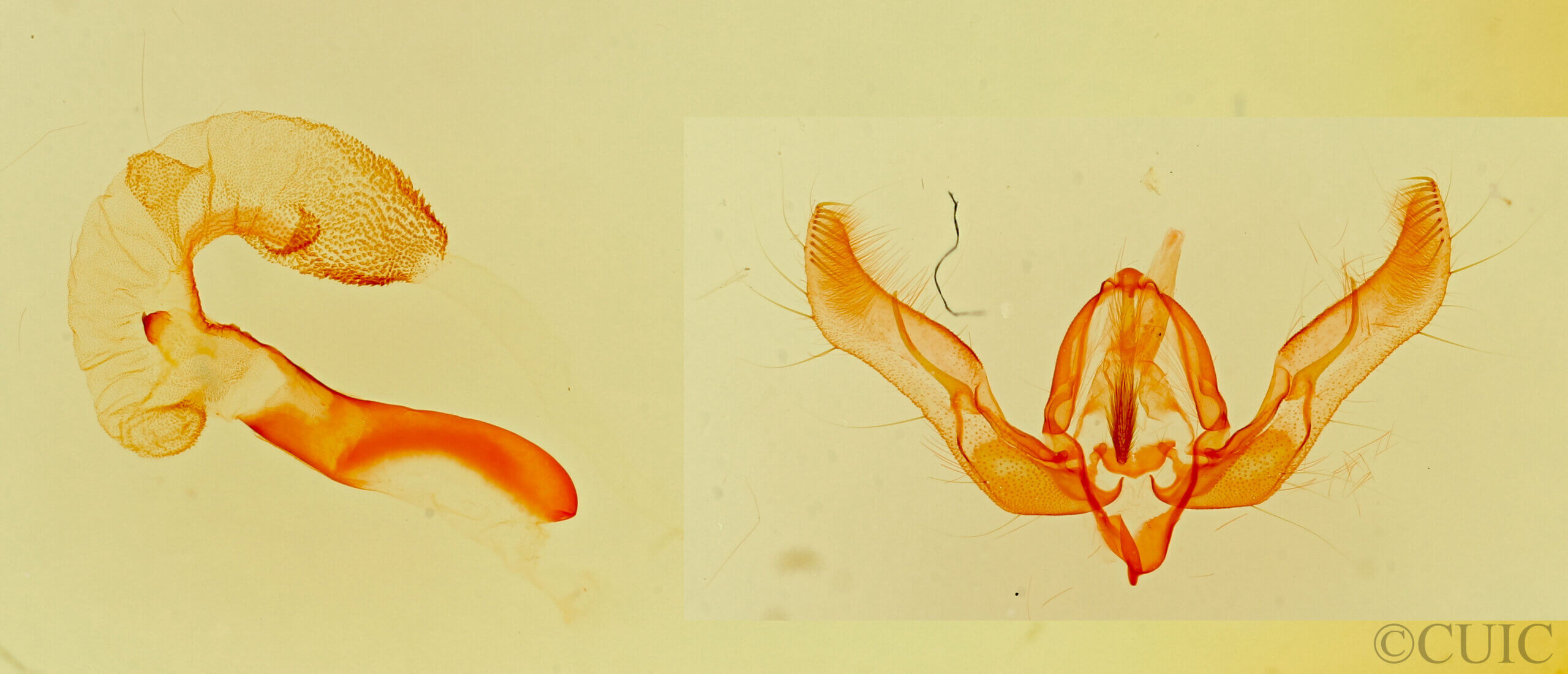 genitalia view of adult Feltia aculifera