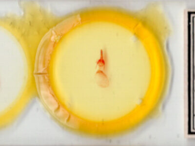 slide view of adult Feltia aculifera