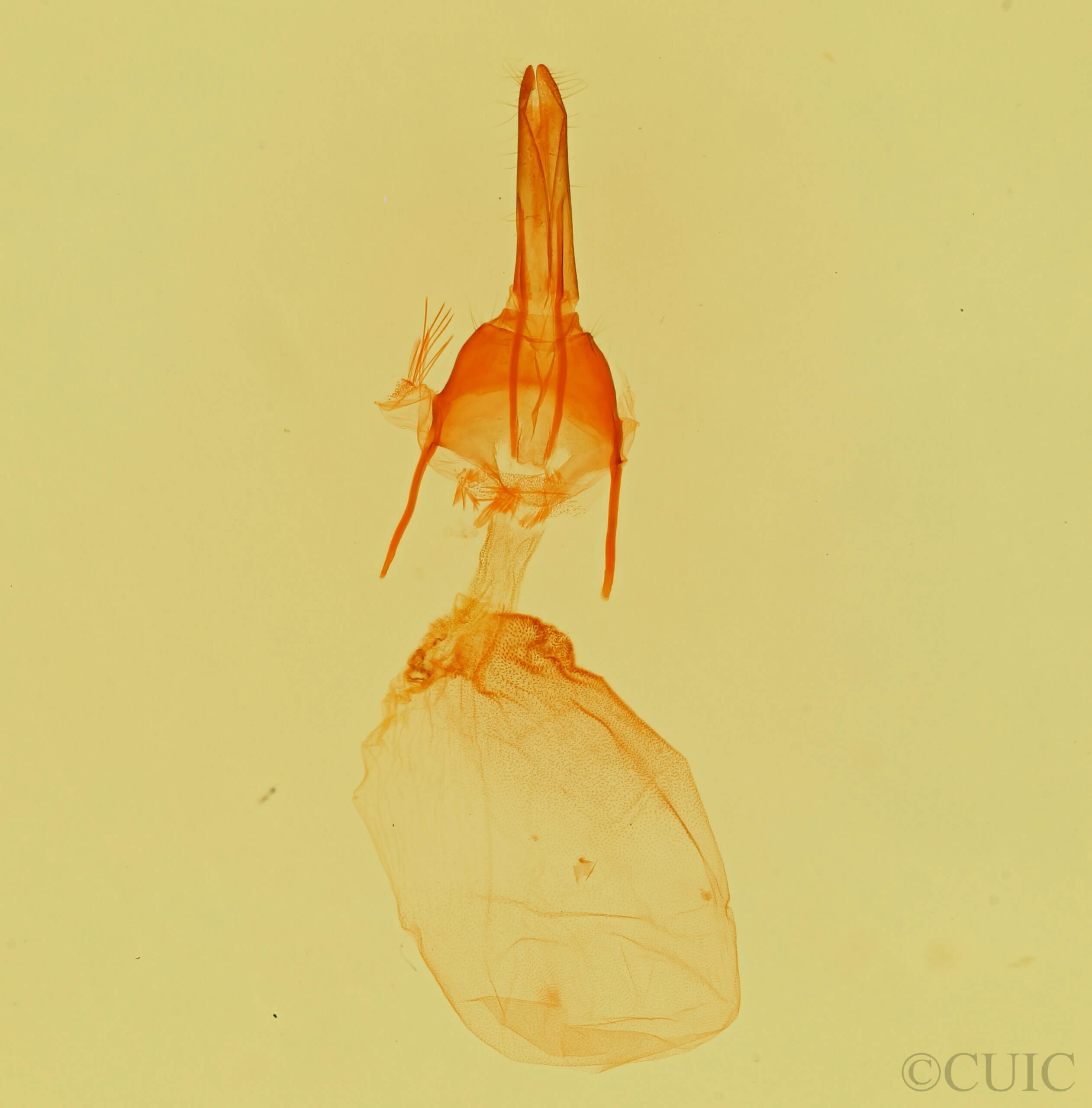 genitalia view of adult Feltia aculifera