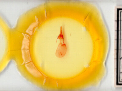 slide view of adult Feltia sp.