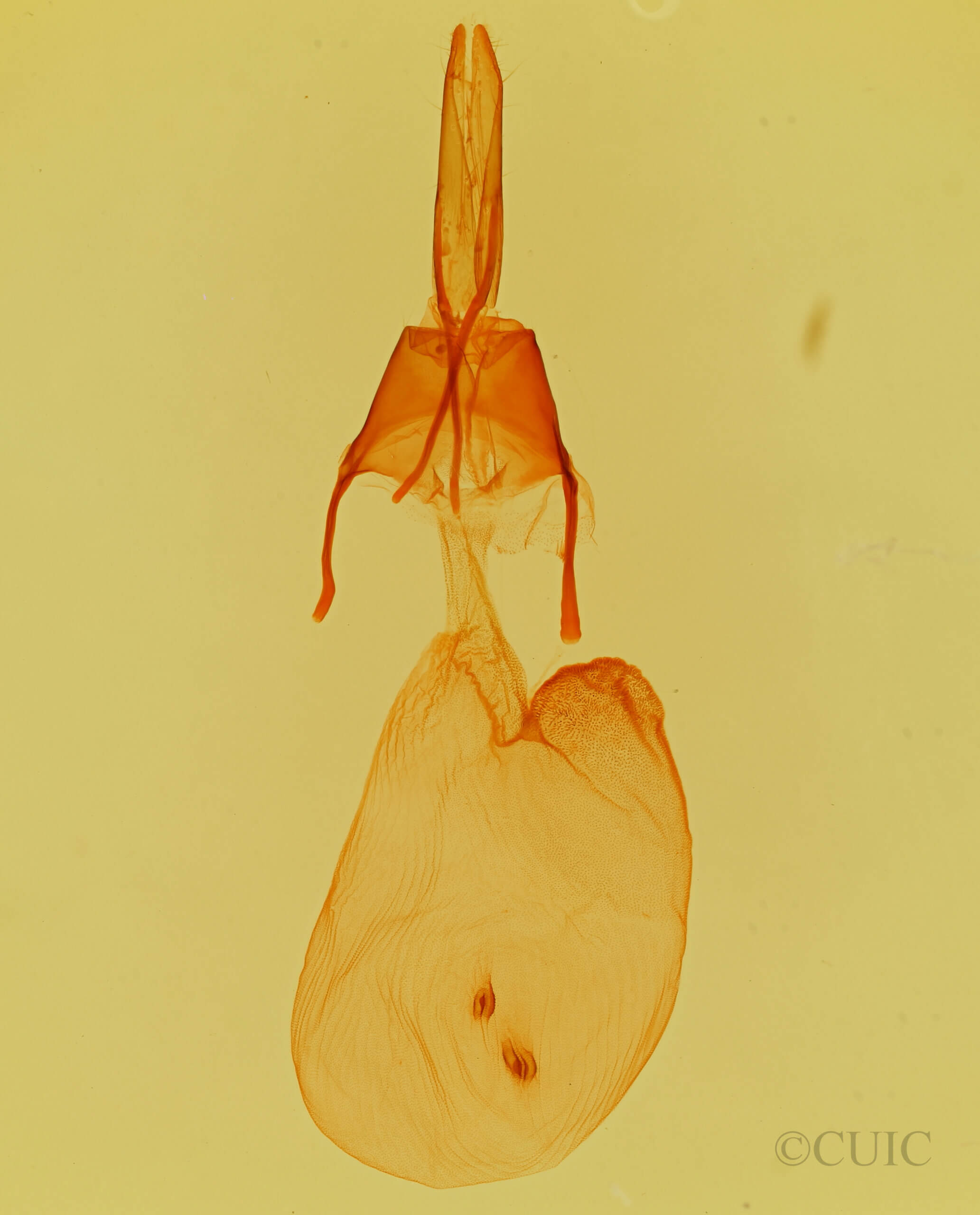 genitalia view of adult Feltia sp.