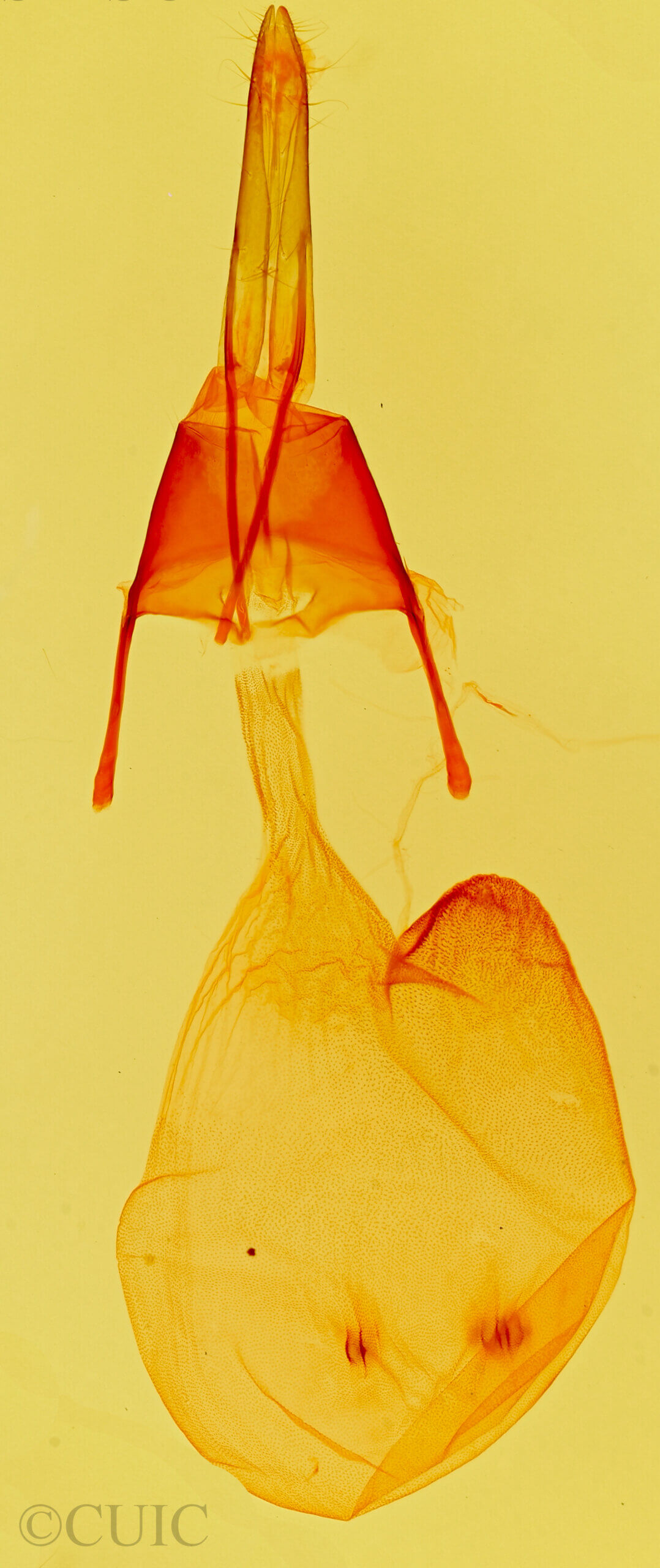 genitalia view of adult Feltia sp.