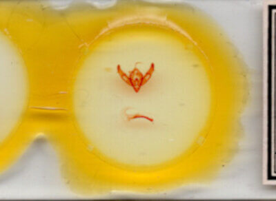 slide view of adult Xestia c-nigrum