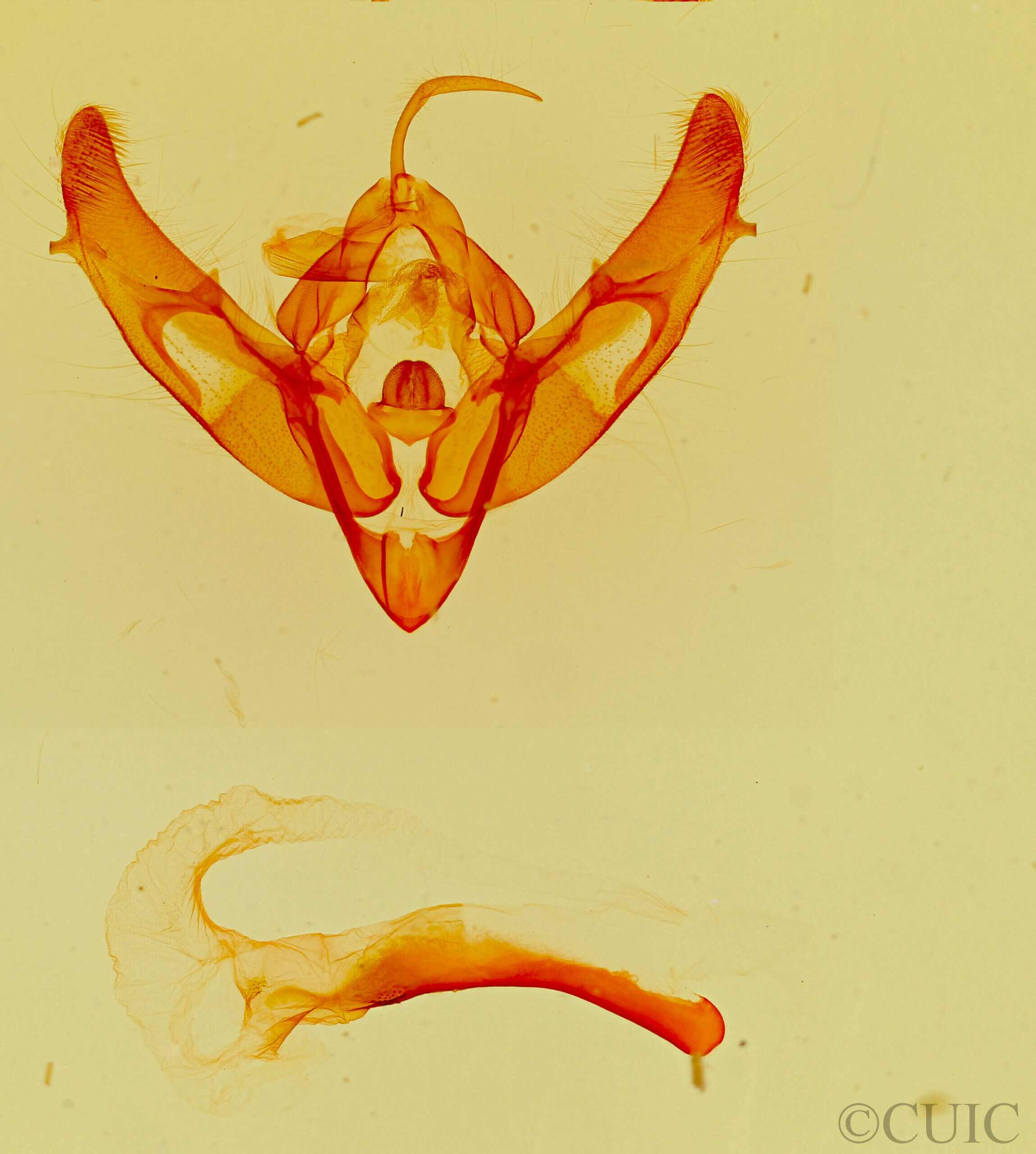 genitalia view of adult Xestia c-nigrum