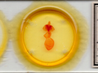 slide view of adult Xestia c-nigrum