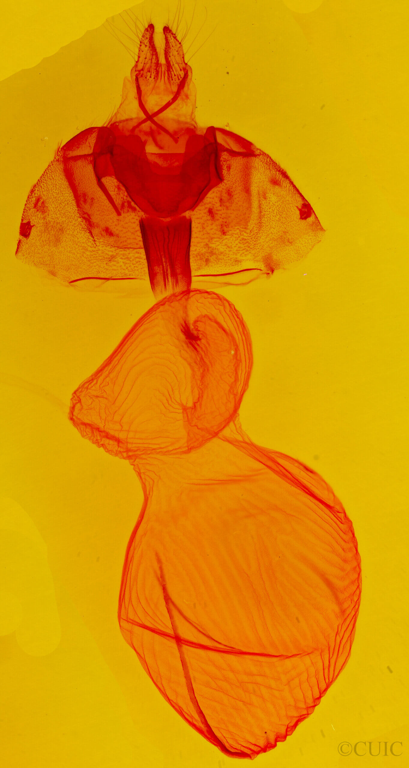 genitalia view of adult Xestia c-nigrum