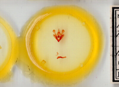 slide view of adult Protorthodes melanopis