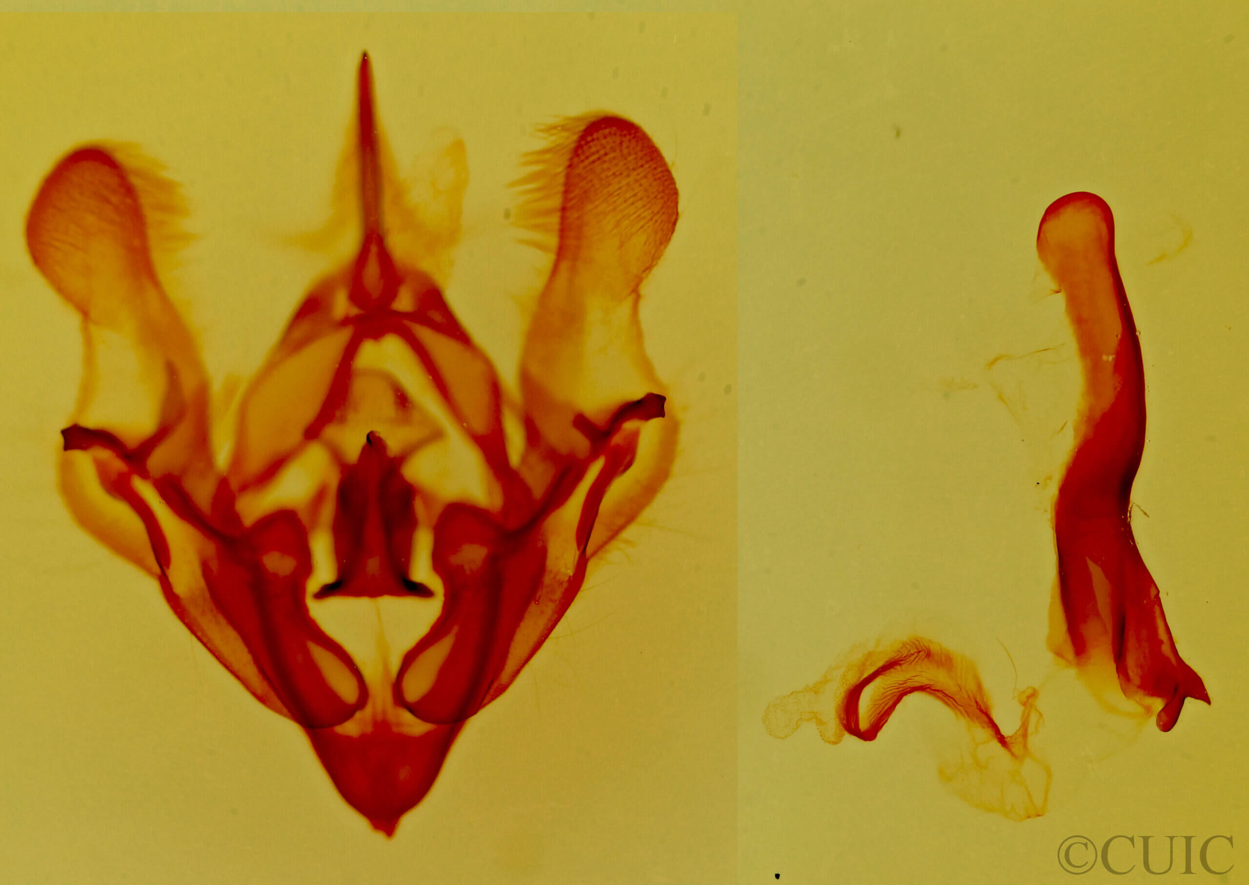 genitalia view of adult Protorthodes melanopis