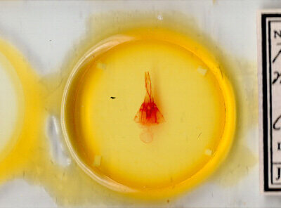 slide view of adult Protorthodes melanopis