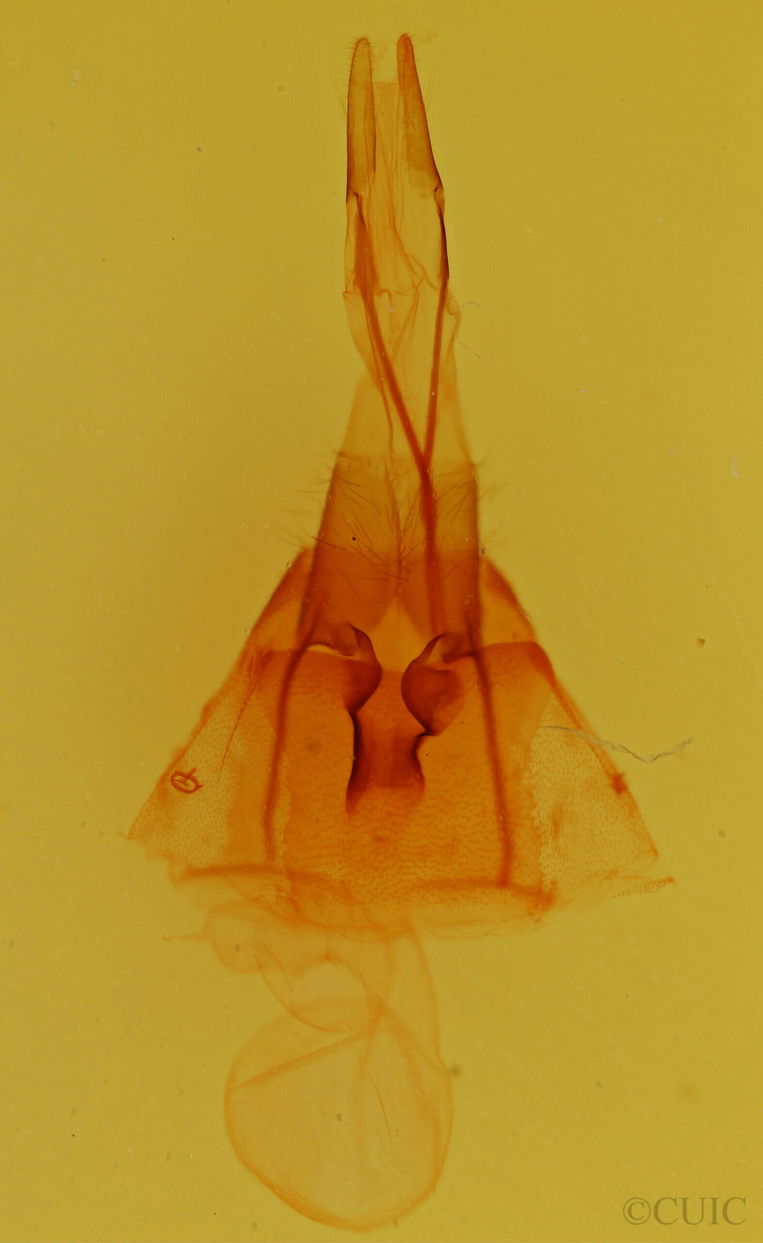 genitalia view of adult Protorthodes melanopis