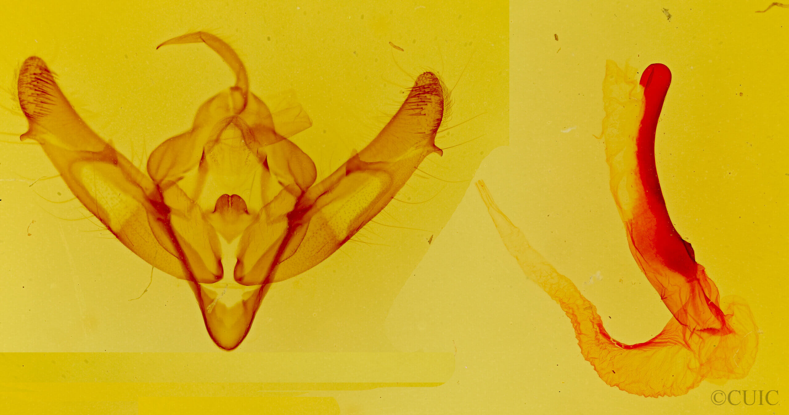 genitalia view of adult Xestia dolosa
