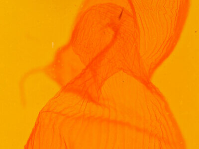 genitalia view of adult Xestia dolosa