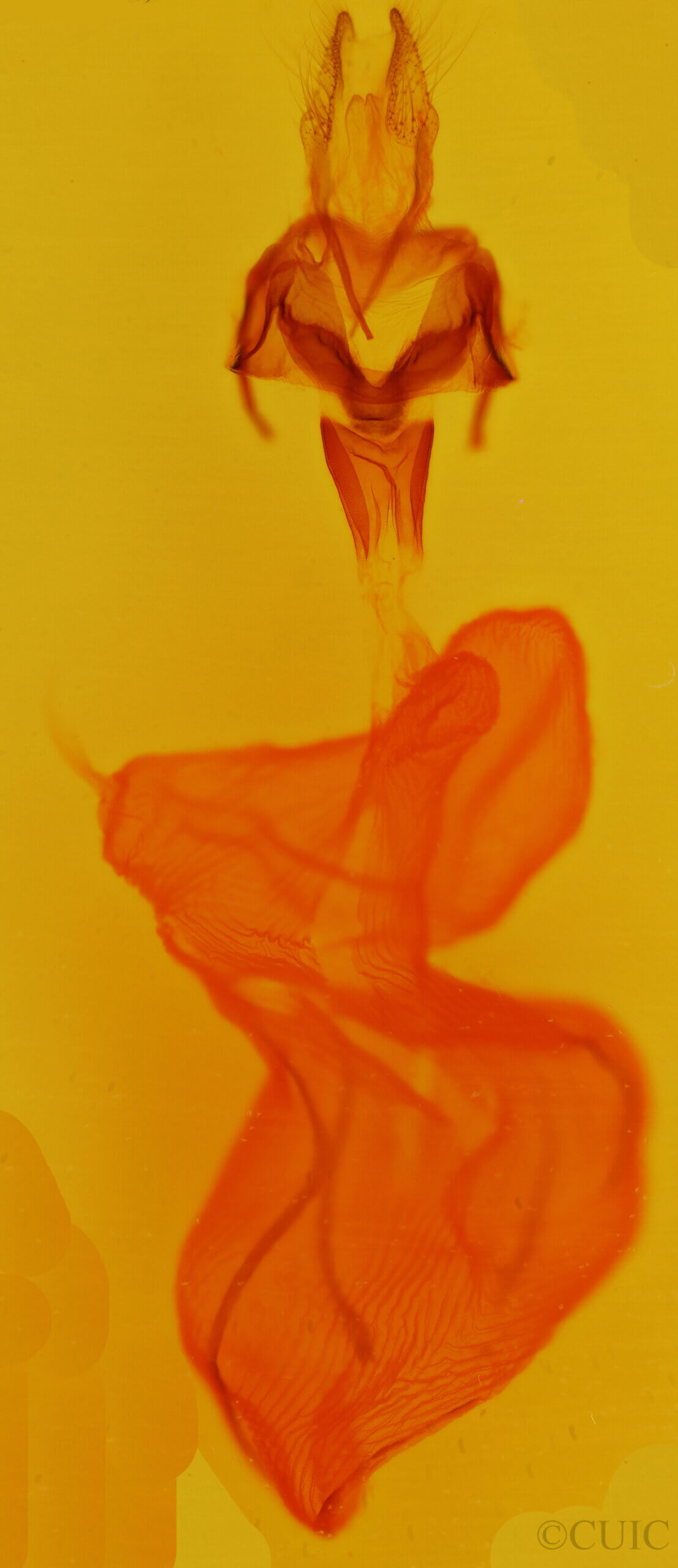 genitalia view of adult Xestia dolosa