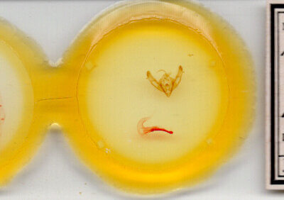 slide view of adult Xestia c-nigrum