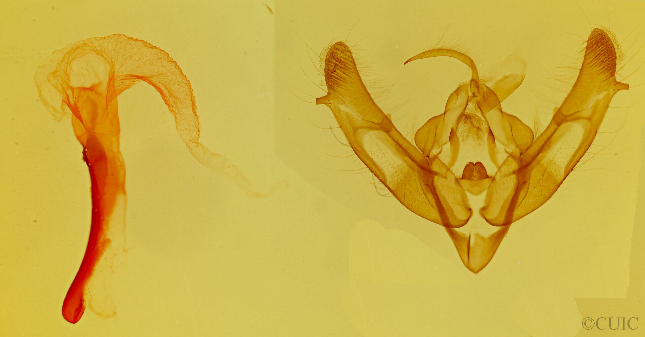 genitalia view of adult Xestia c-nigrum