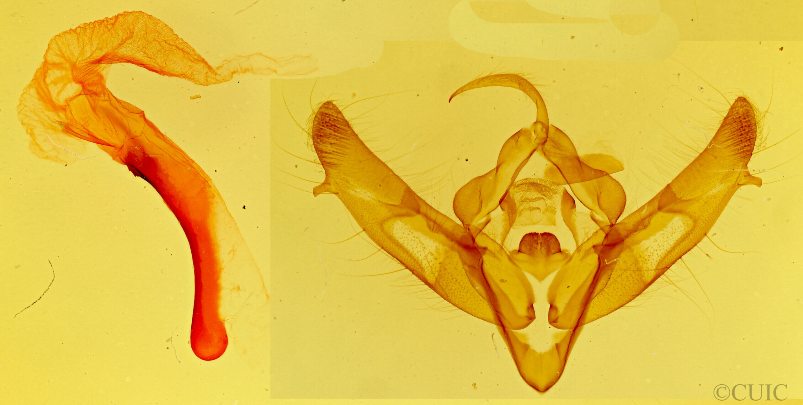 genitalia view of adult Xestia c-nigrum