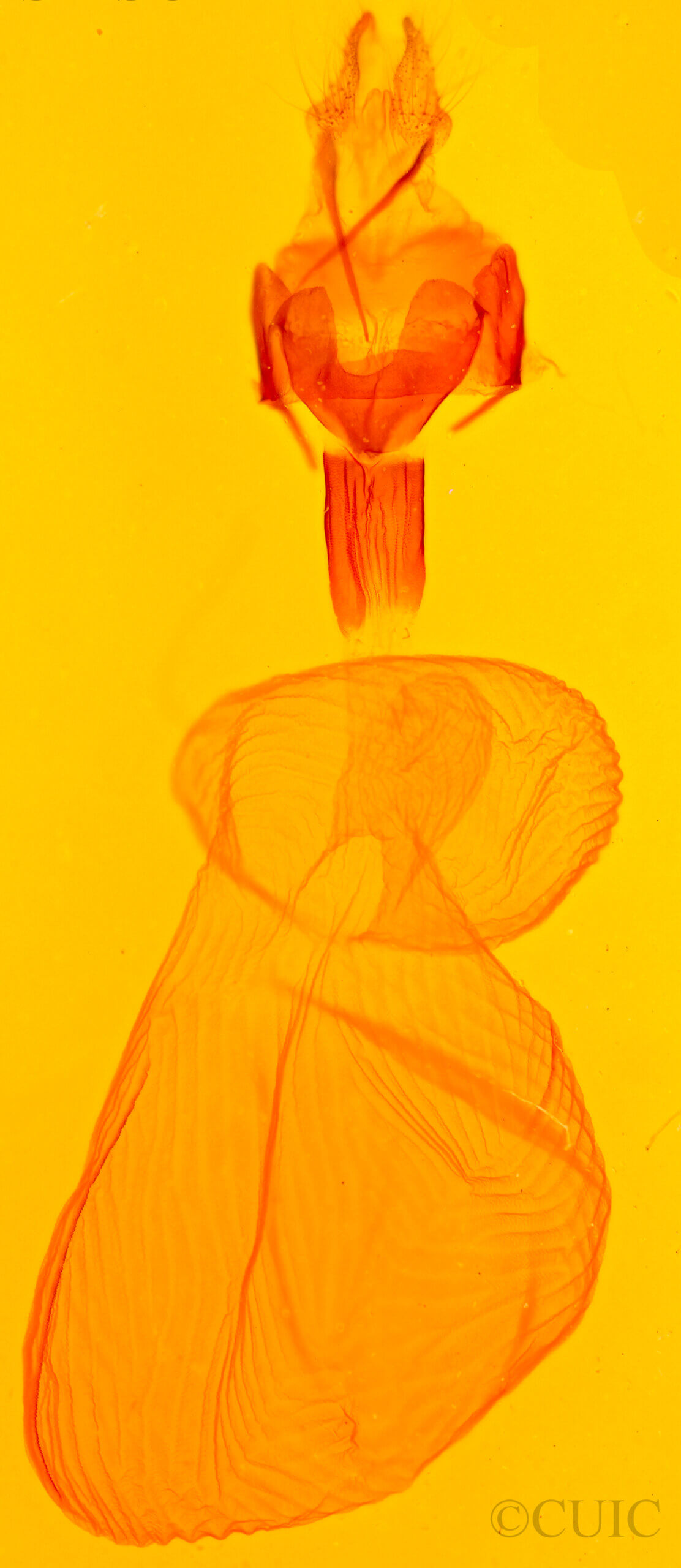 genitalia view of adult Xestia c-nigrum