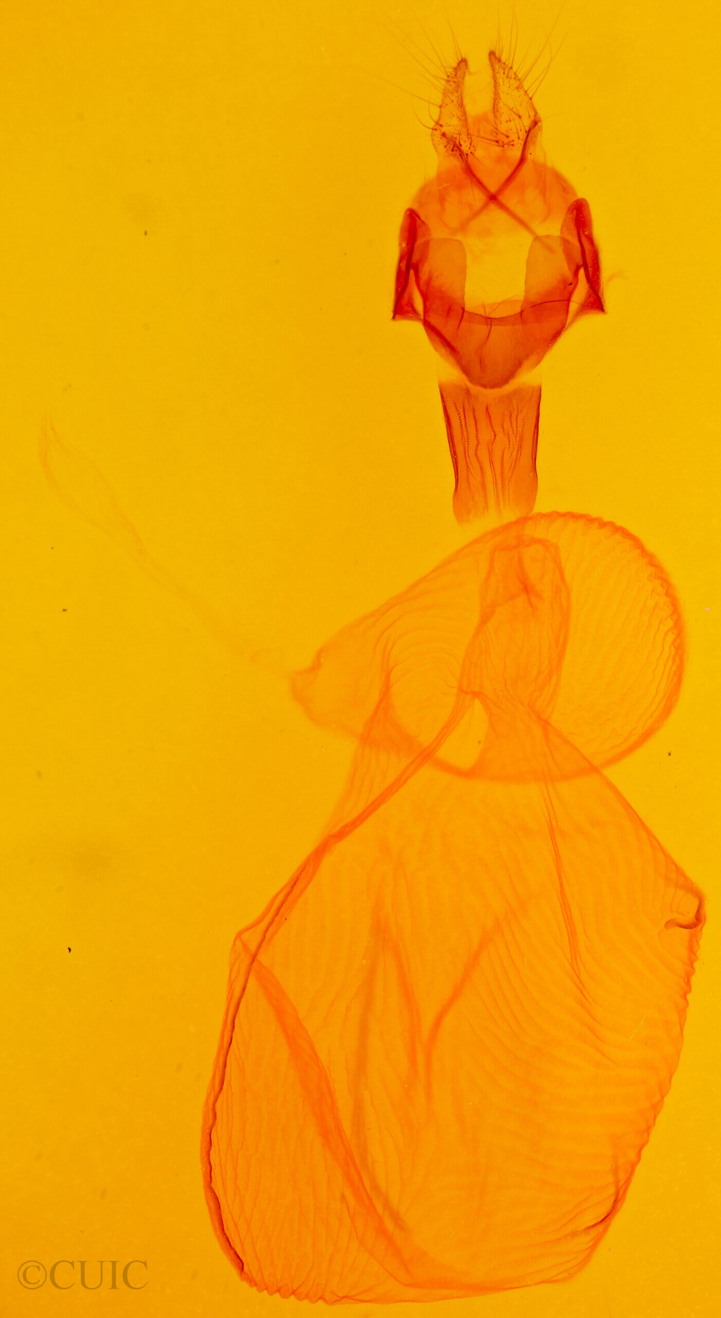 genitalia view of adult Xestia c-nigrum