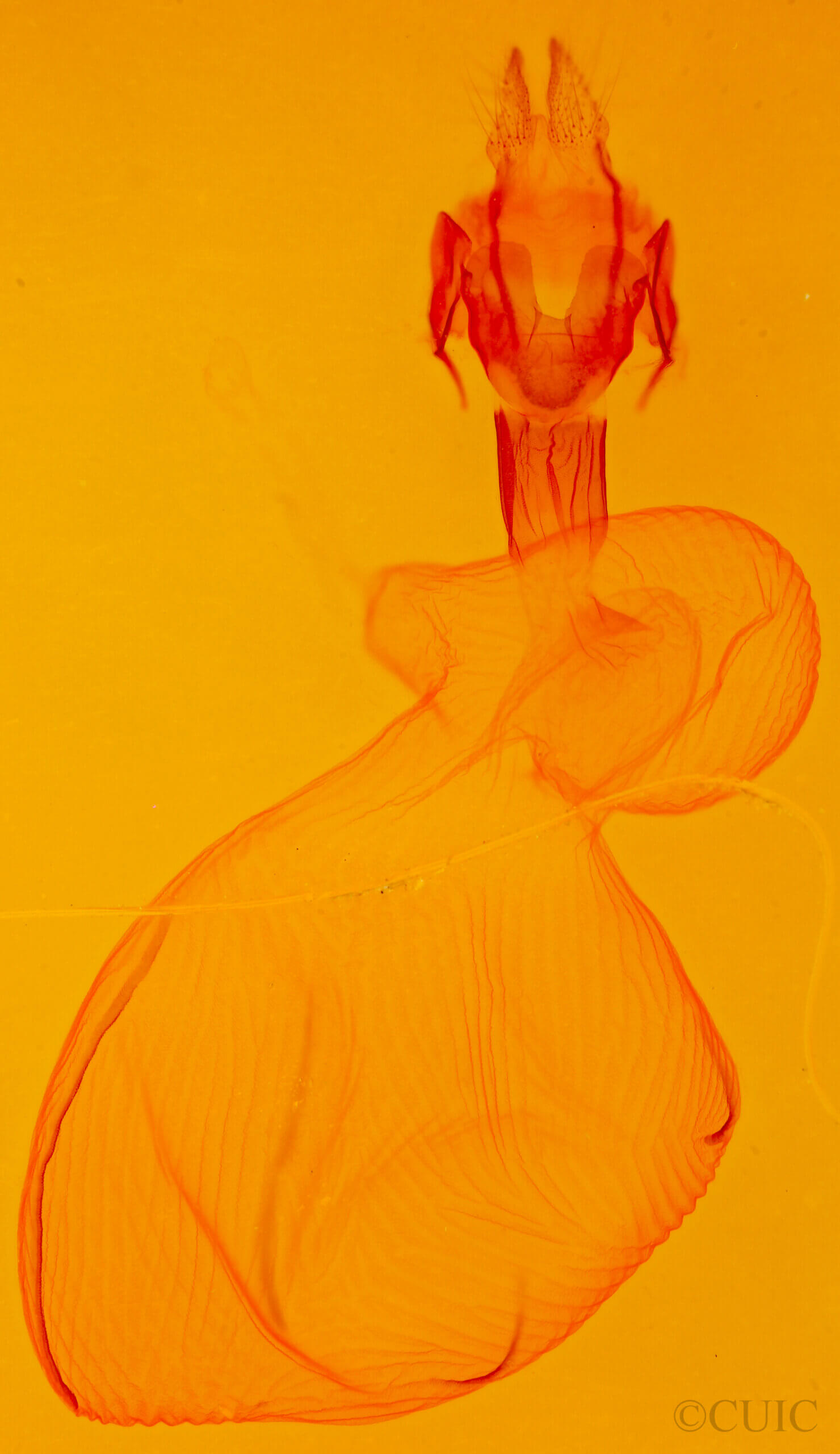 genitalia view of adult Xestia c-nigrum