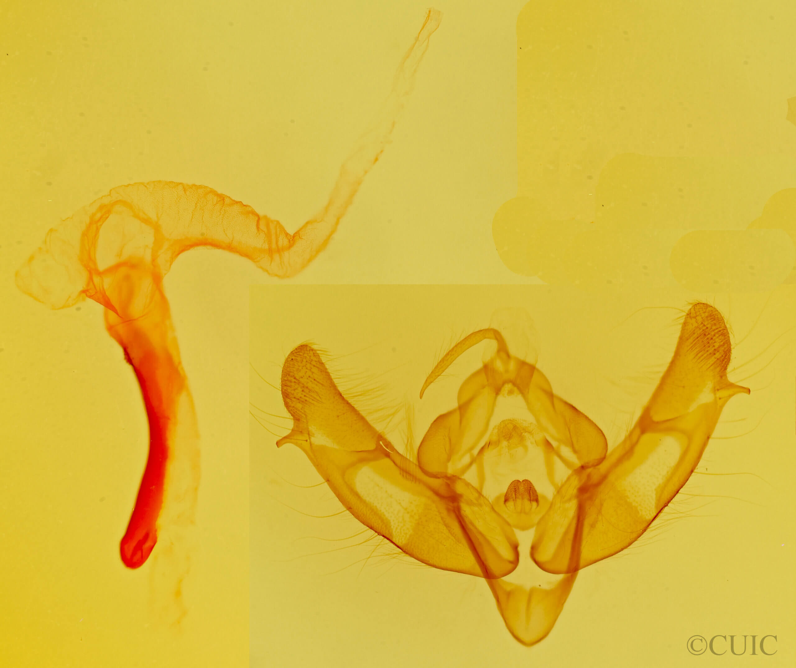 genitalia view of adult Xestia c-nigrum