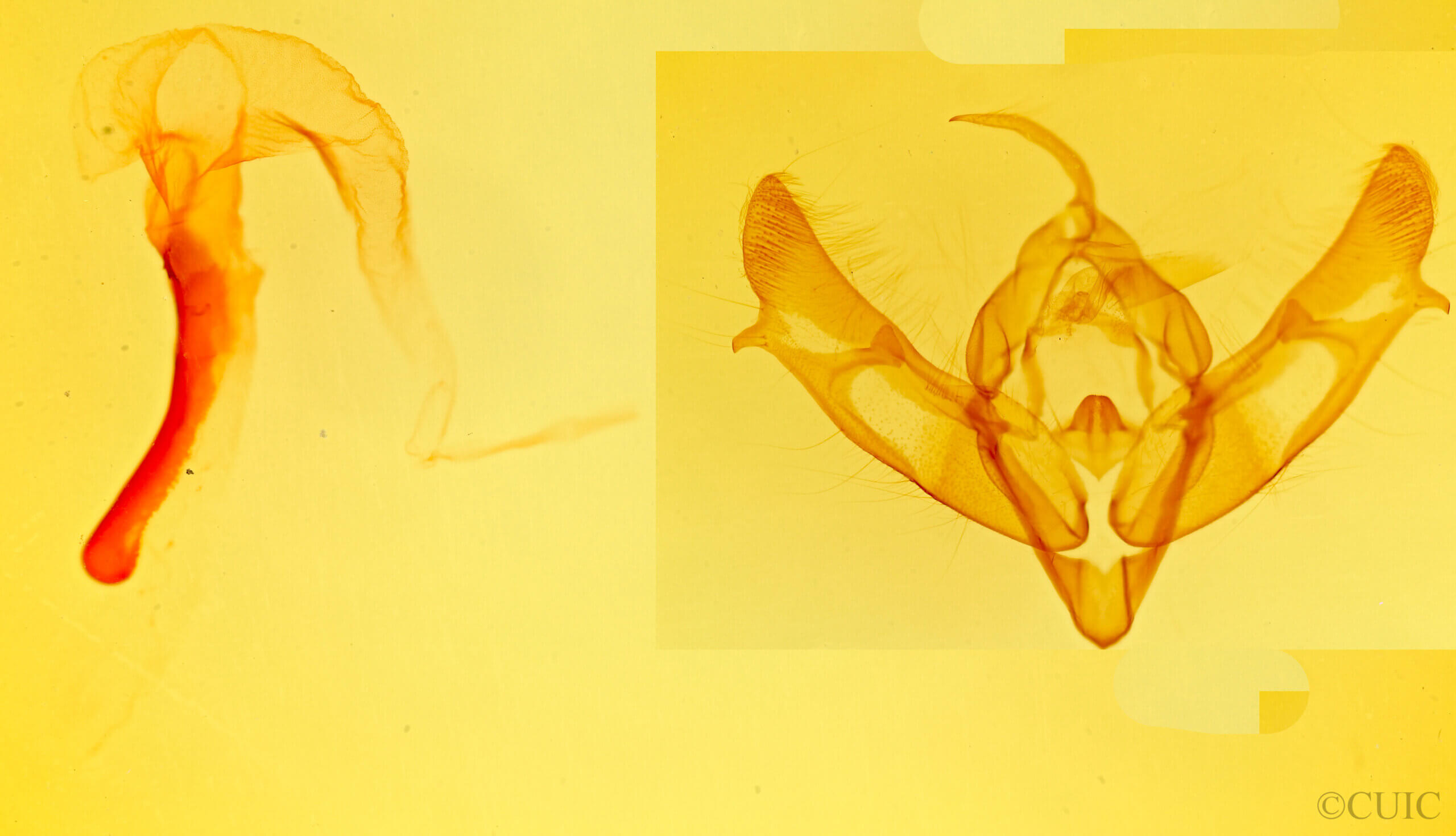 genitalia view of adult Xestia c-nigrum