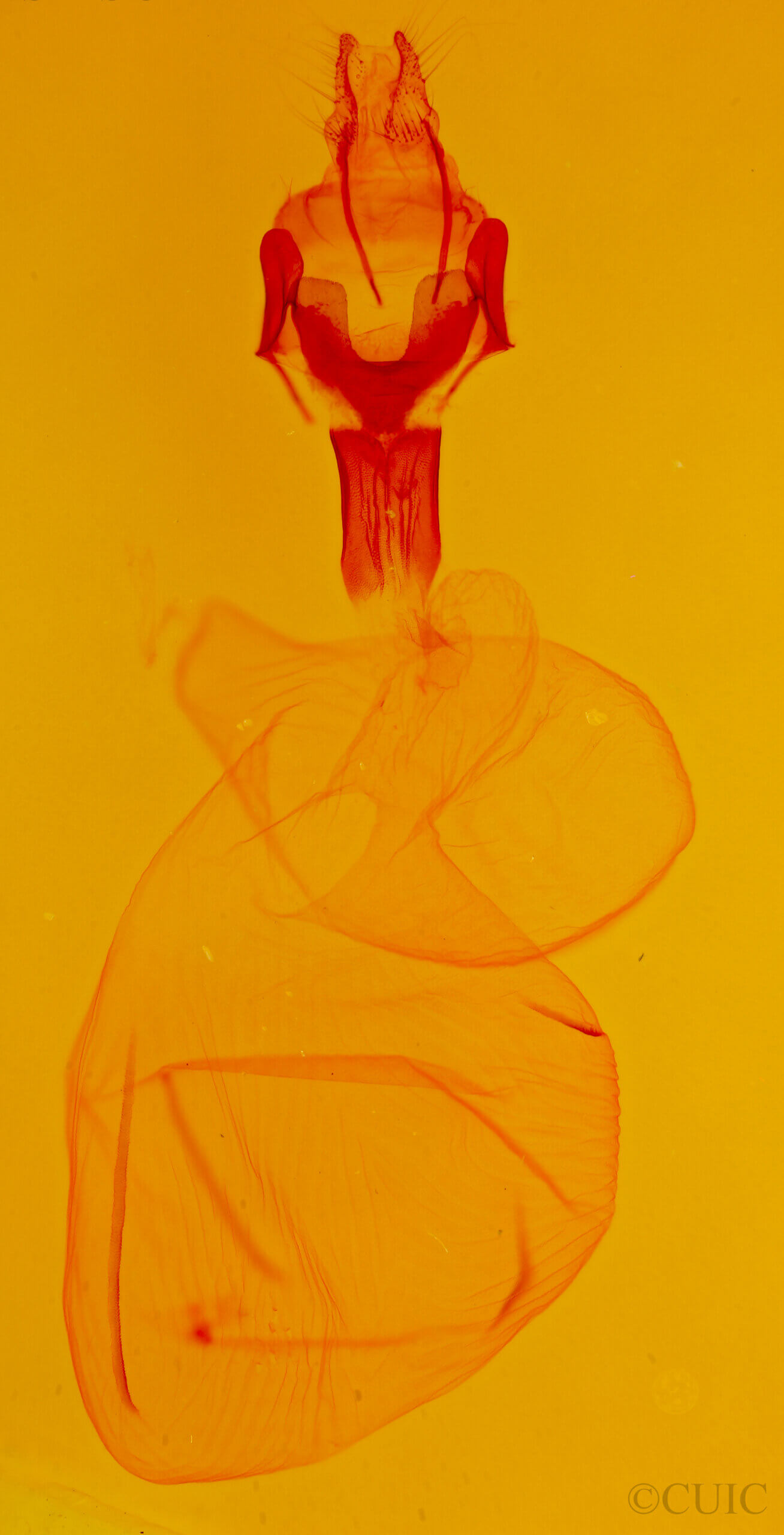 genitalia view of adult Xestia c-nigrum