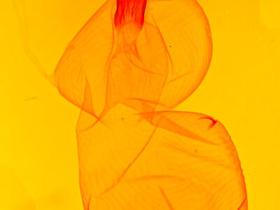 genitalia view of adult Xestia c-nigrum