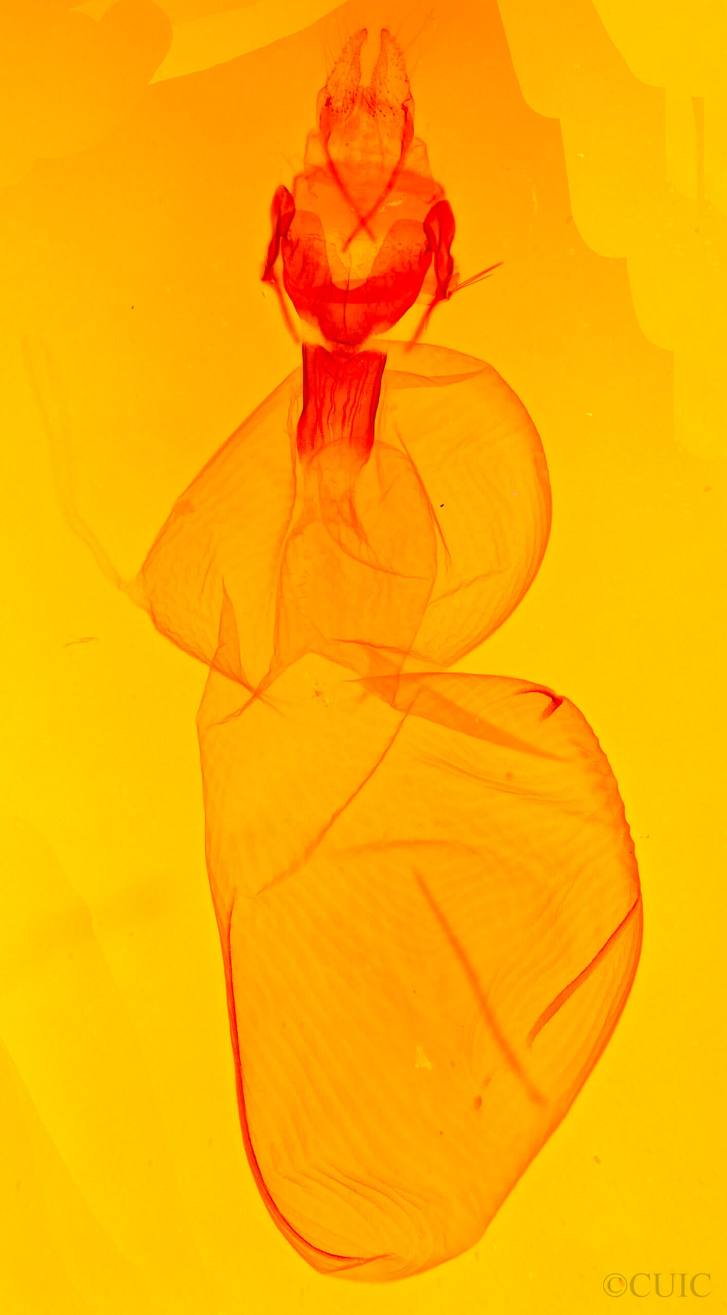 genitalia view of adult Xestia c-nigrum