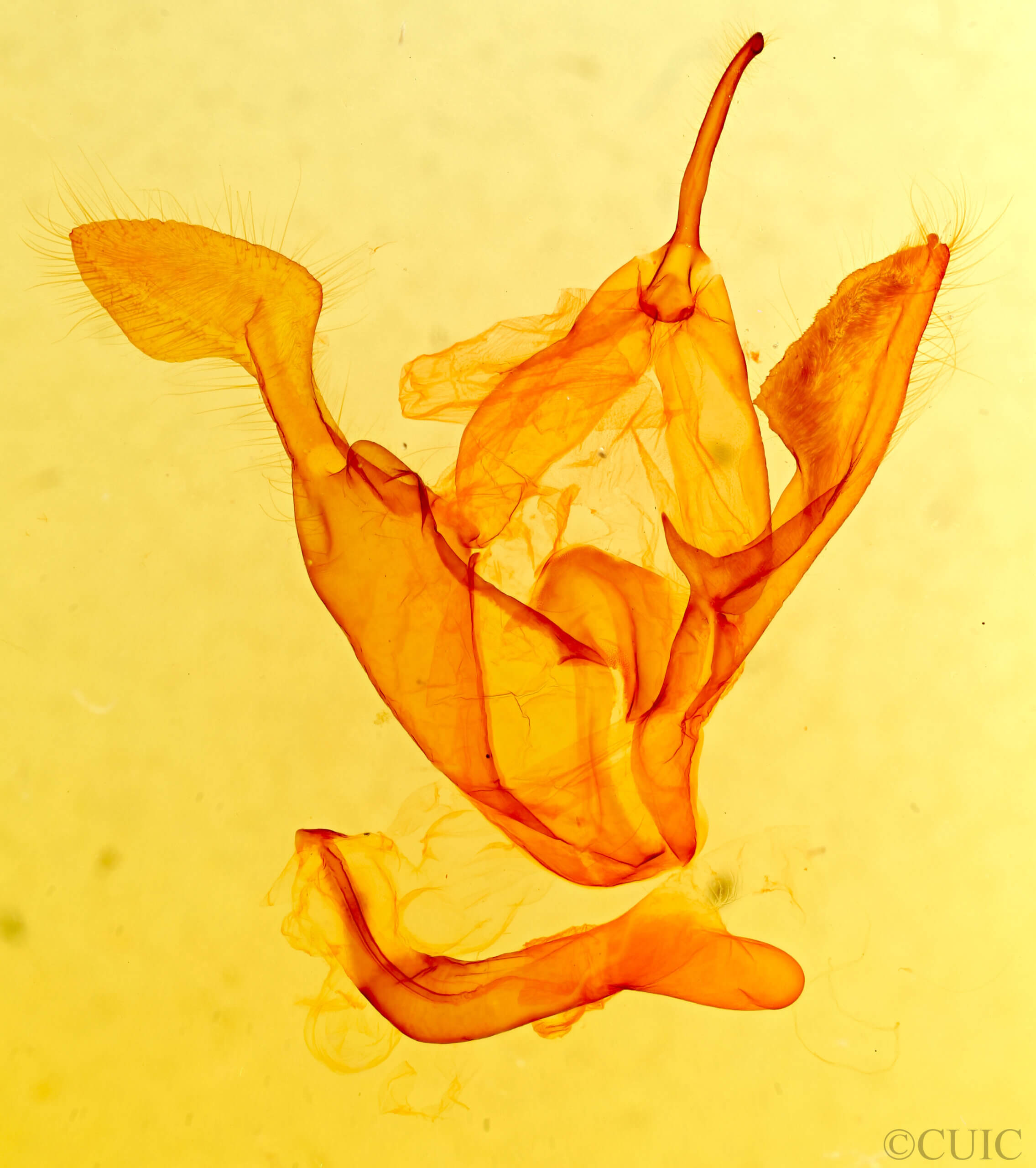 genitalia view of adult Zale sp.