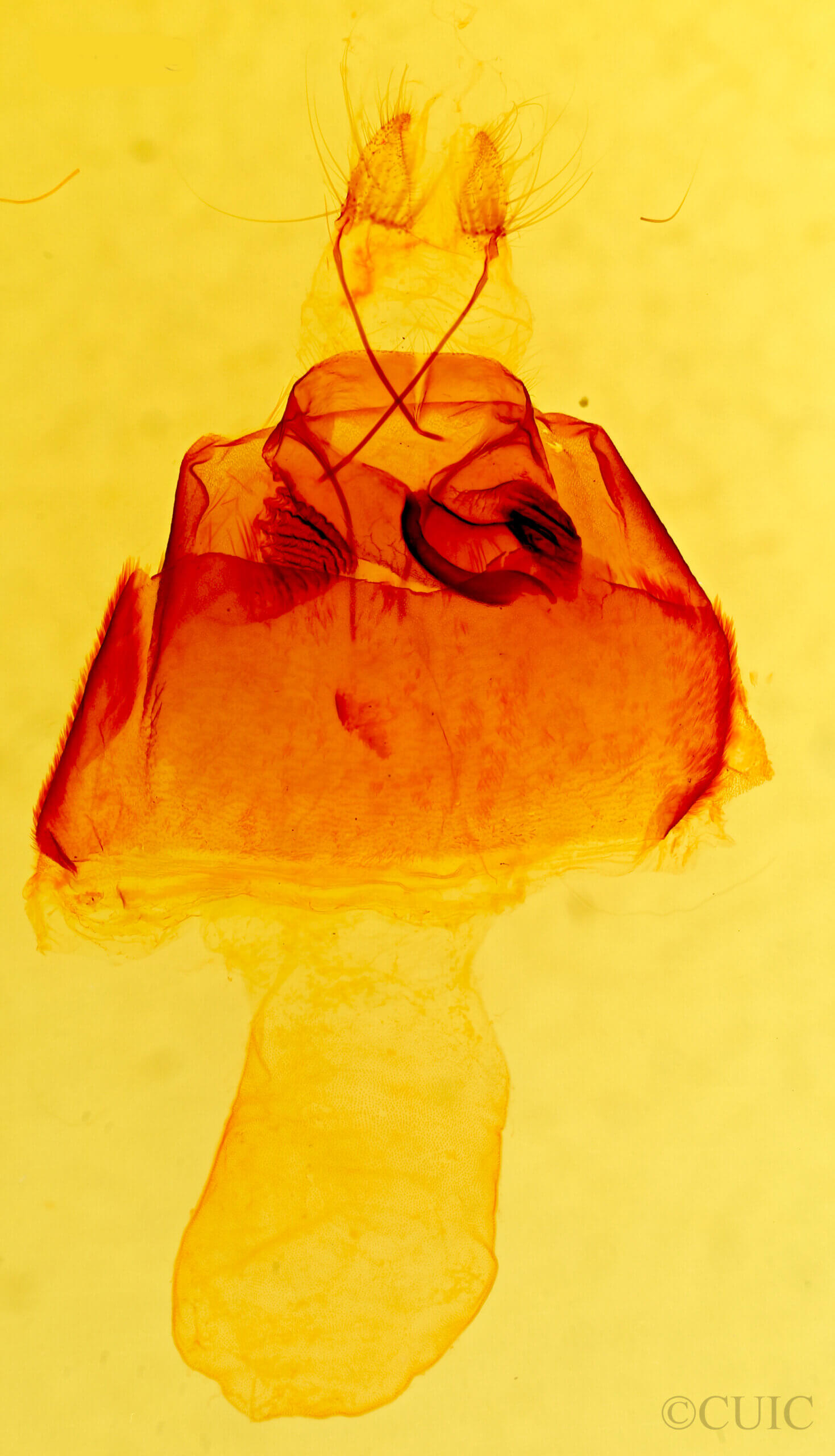 genitalia view of adult Zale sp.