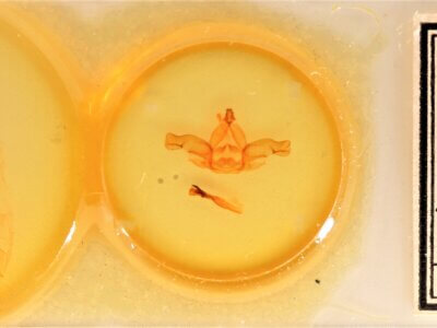 slide view of adult Nadata syndroma n. sp.