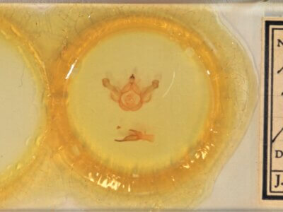 slide view of adult Nerica bidentata