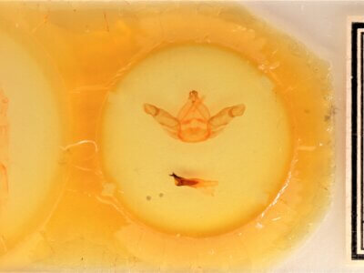 slide view of adult Nadata gibbosa