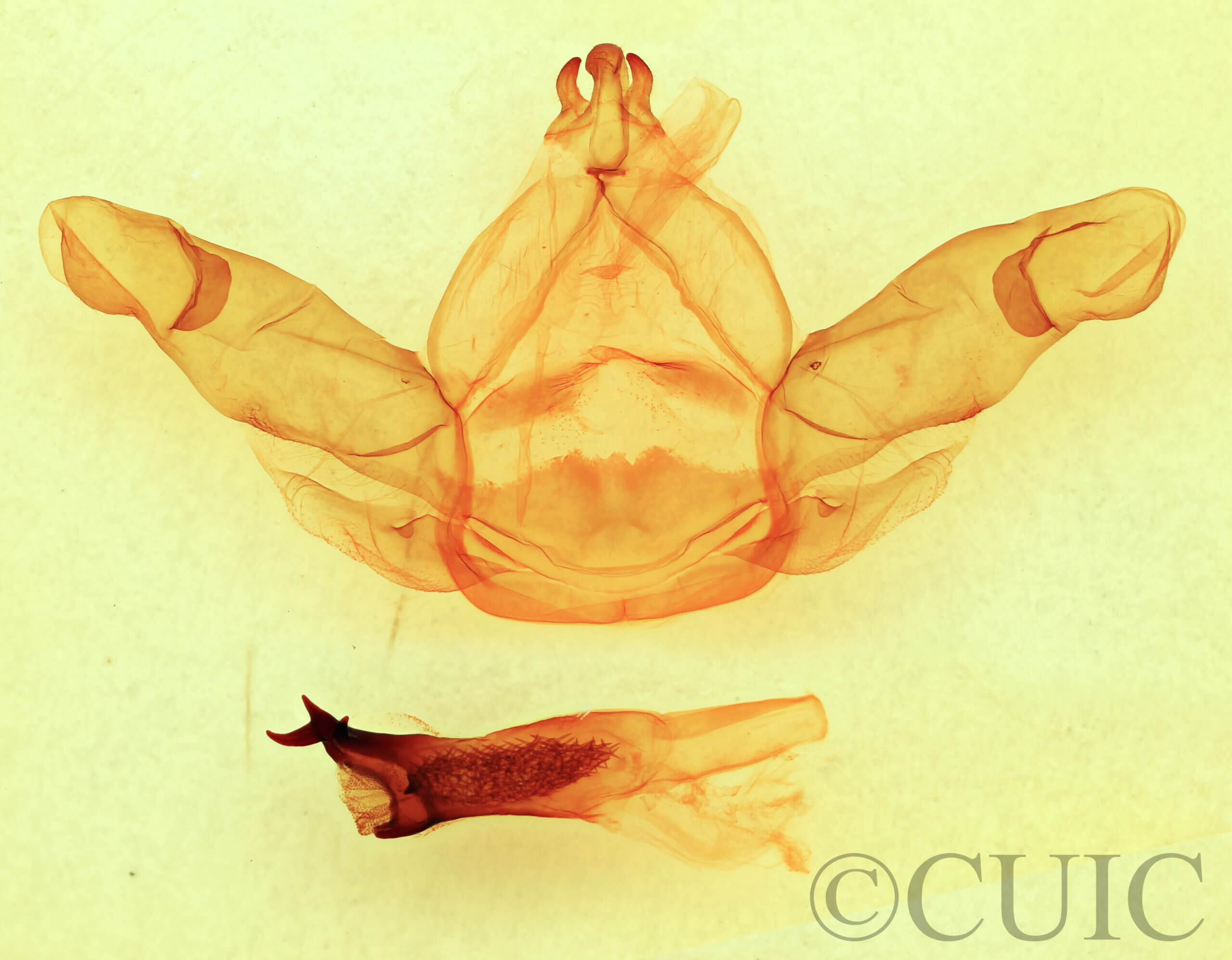 genitalia view of adult Nadata gibbosa