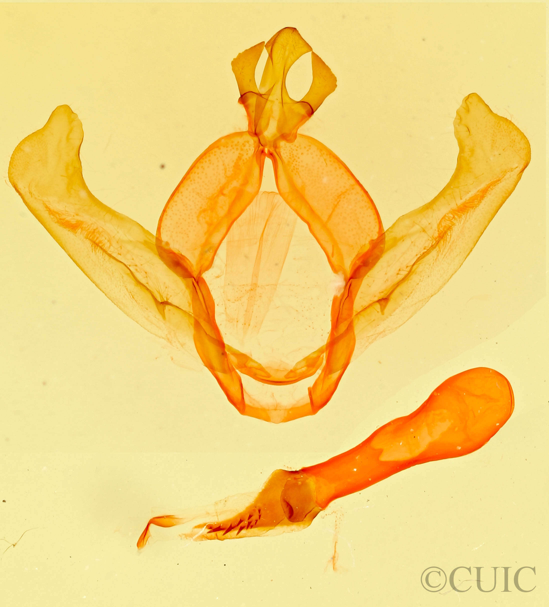 genitalia view of adult Hyparpax aurostriata