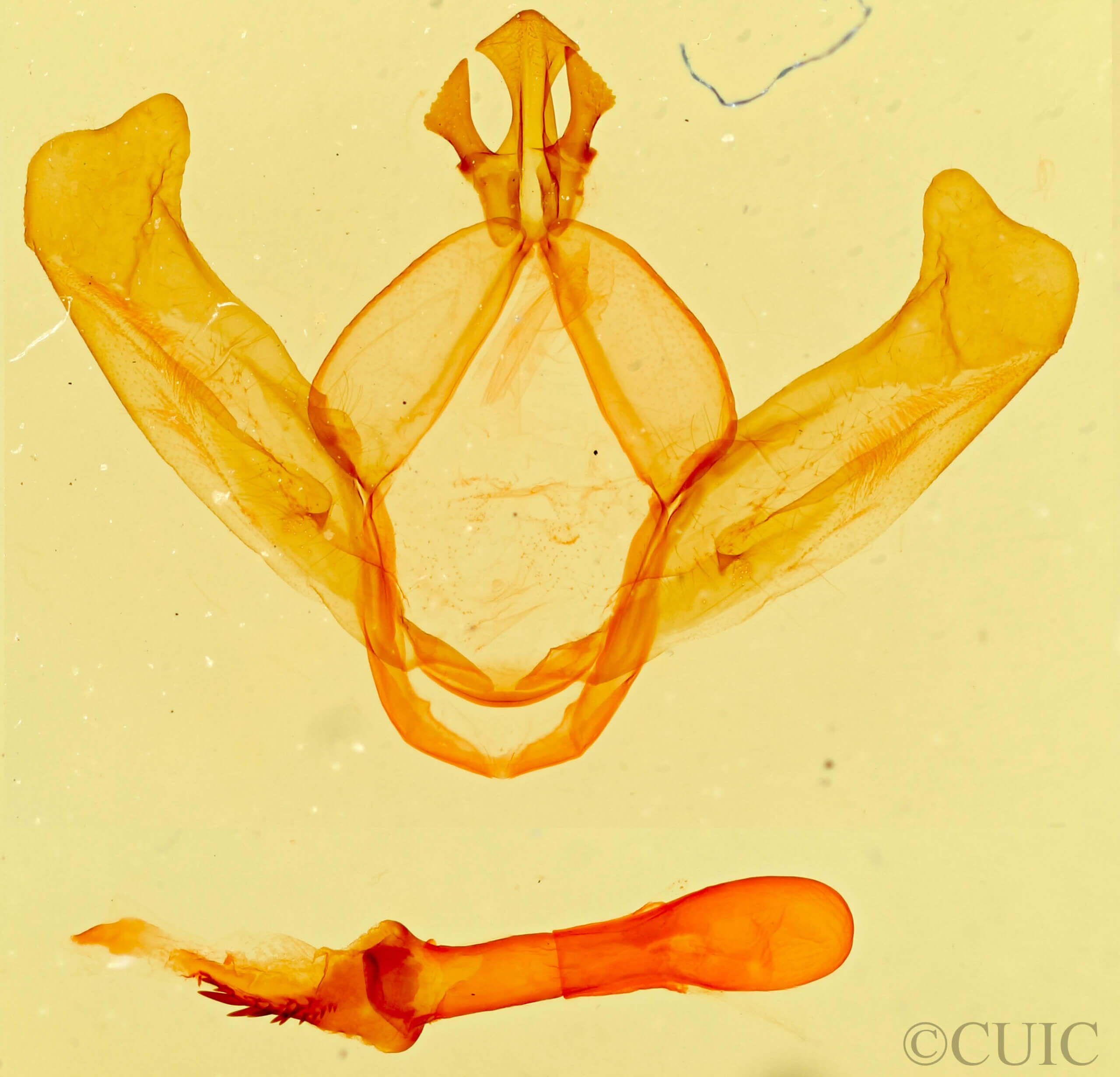 genitalia view of adult Hyparpax minor