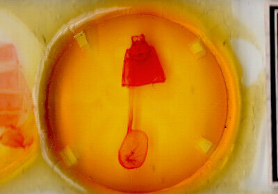 slide view of adult Pseudhapigia brunnea