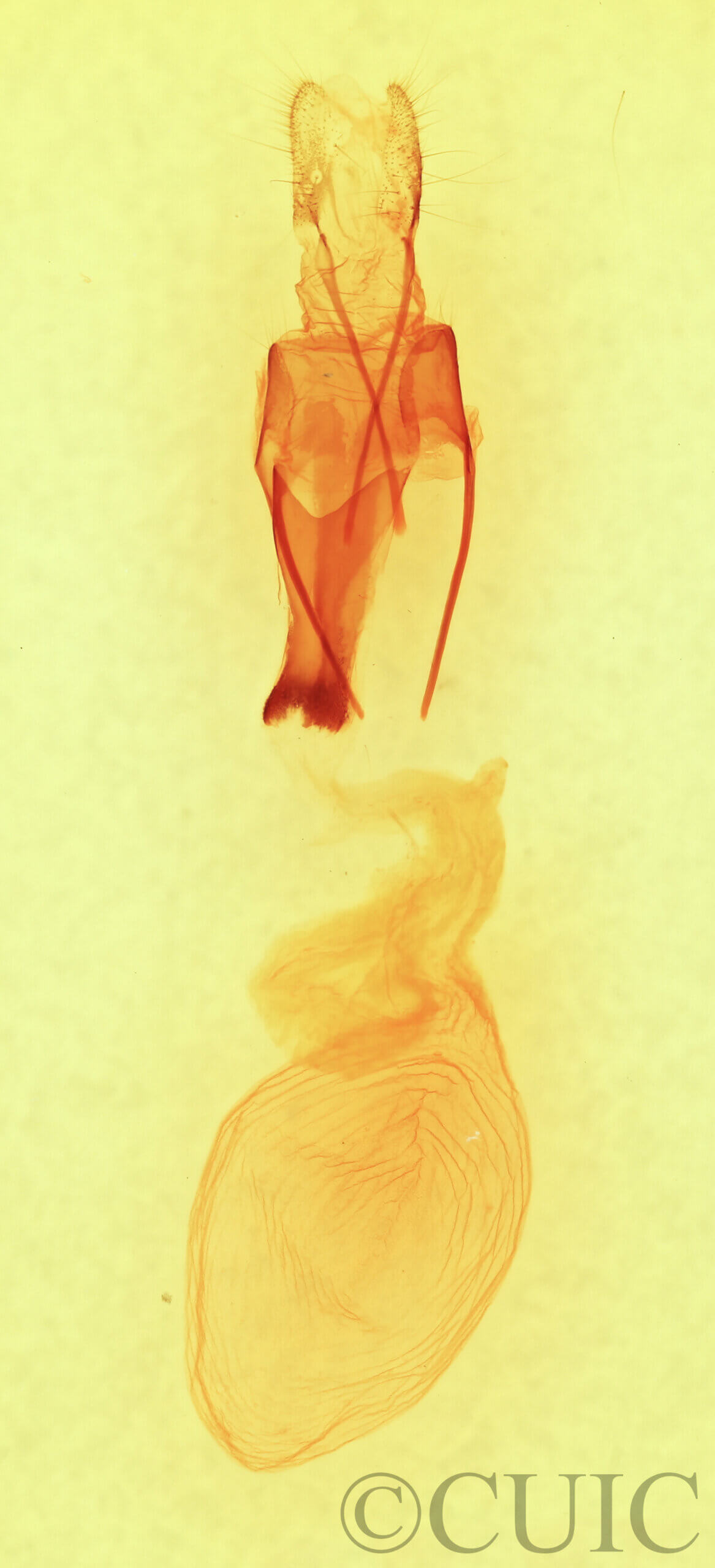 genitalia view of adult Sympistis forbesi