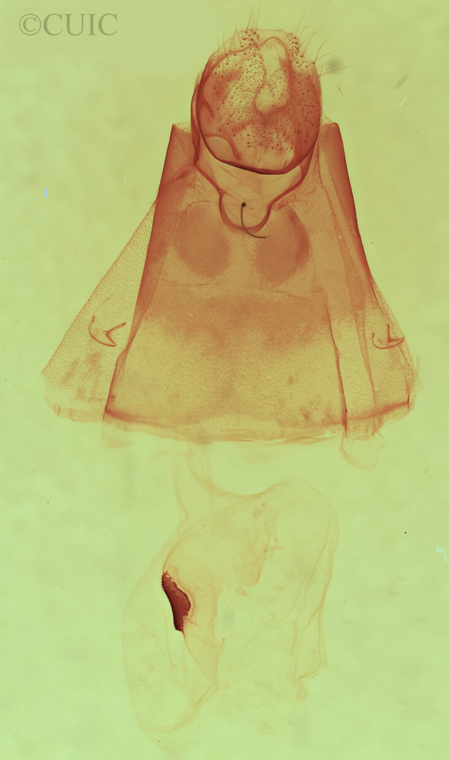 genitalia view of adult Clostera albosigma