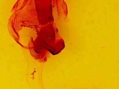 genitalia view of adult Egira perlubens