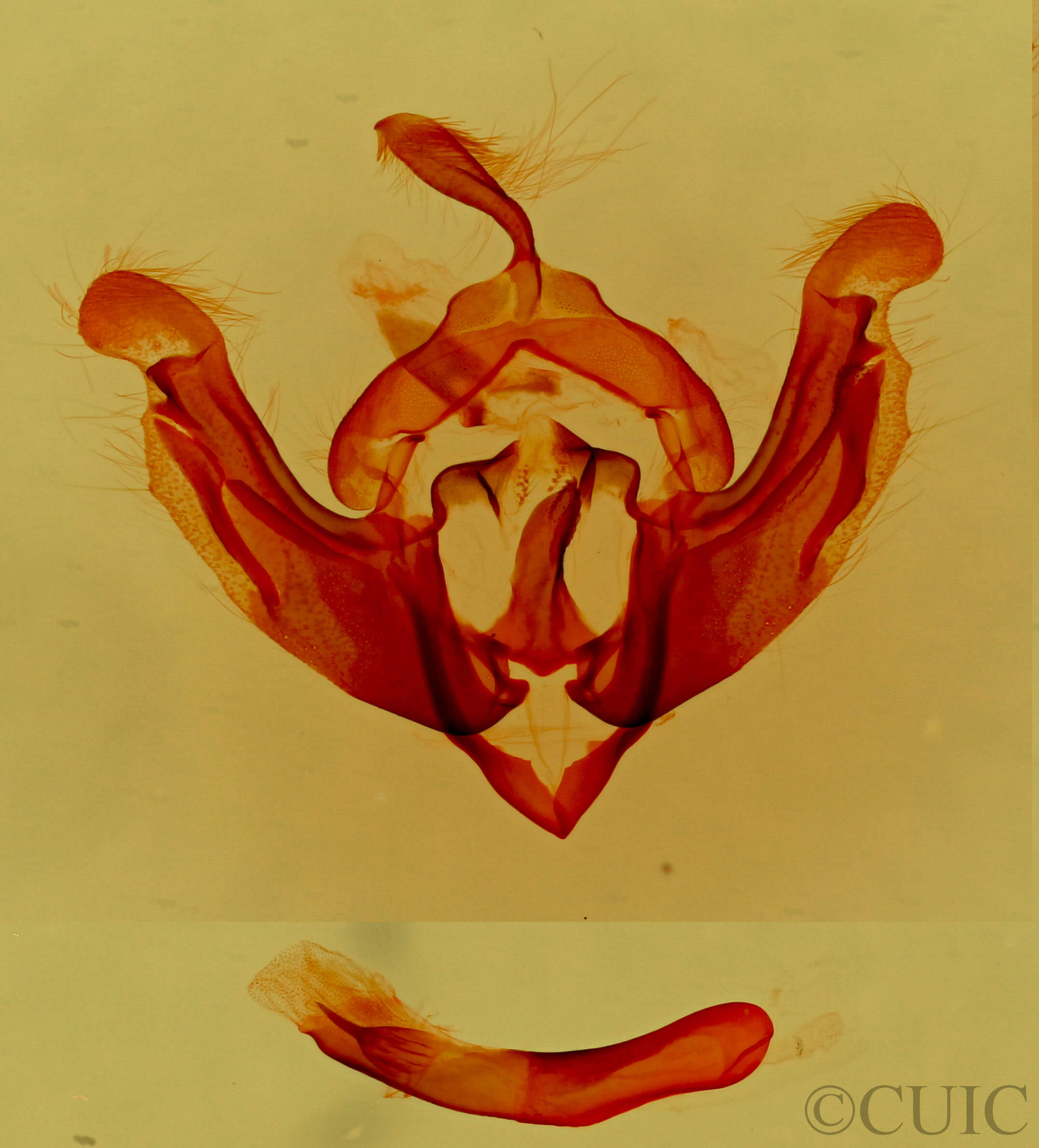 genitalia view of adult Hadenella pergentilis