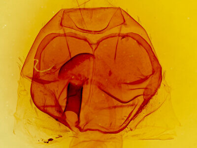 genitalia view of adult Zale metata