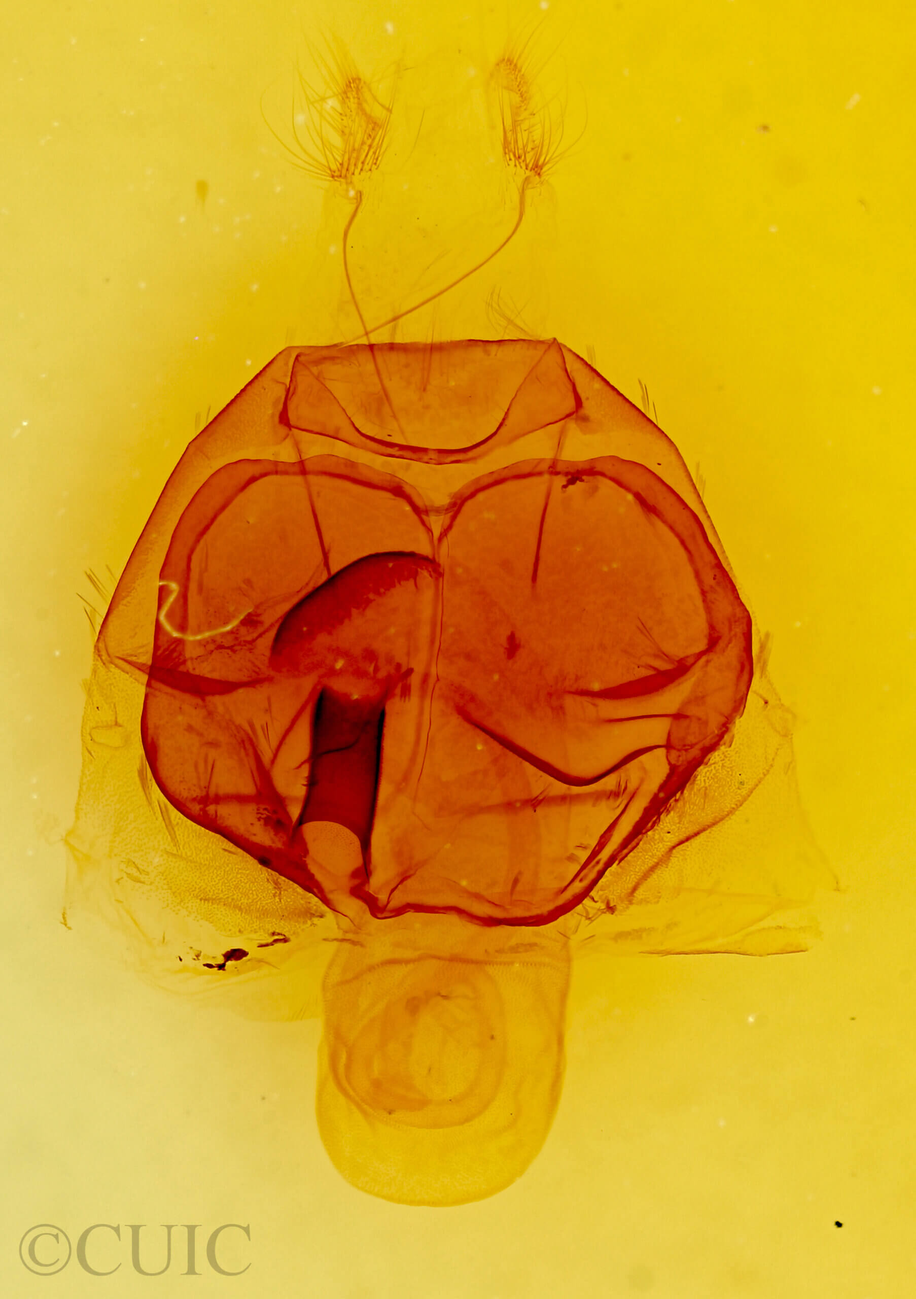 genitalia view of adult Zale metata