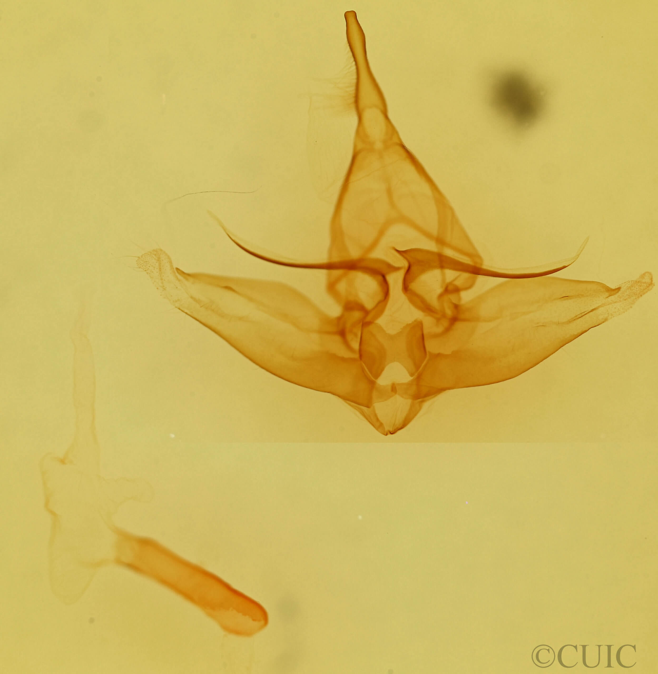 genitalia view of adult Lophocampa sp.
