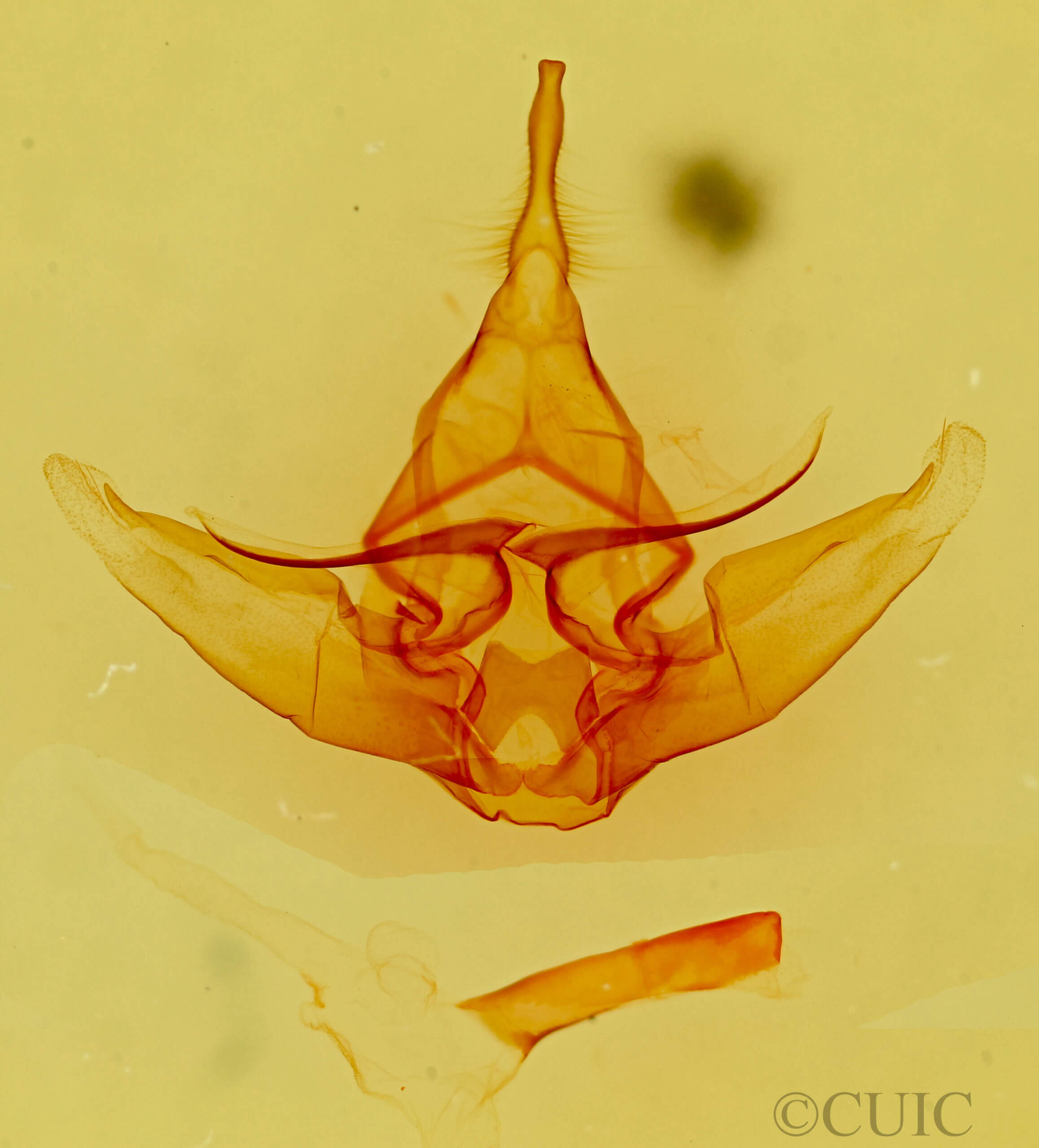 genitalia view of adult Lophocampa caryae